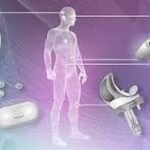 Arthroscopy